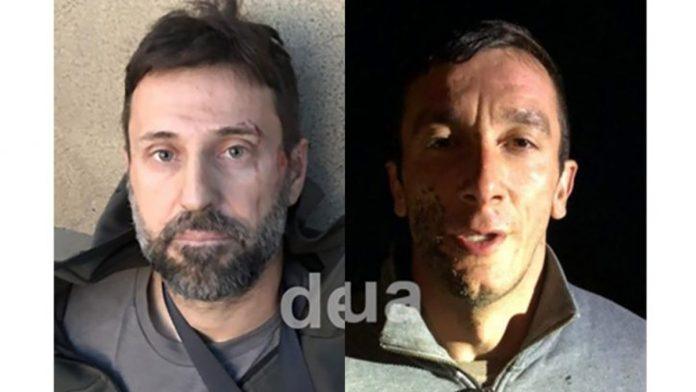 ukrajina-mora-da-plati-srbima-skoro-12-hiljada-evra-odstete-evropski-sud-utvrdio-da-su-osumnjicenima-za-pokusaj-ubistva-radoja-zvicera-povredena-prava