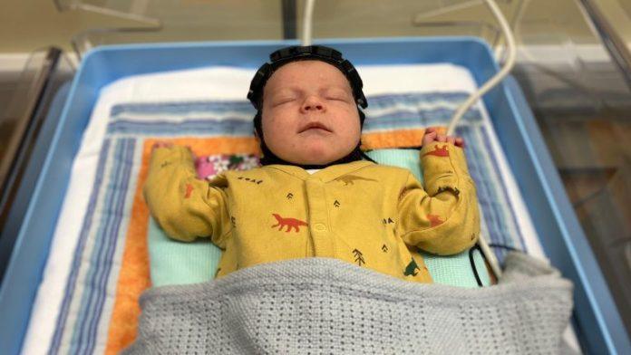 revolucionarna-kapa-za-mozak-–-nada-za-bebe-rodene-sa-povredama