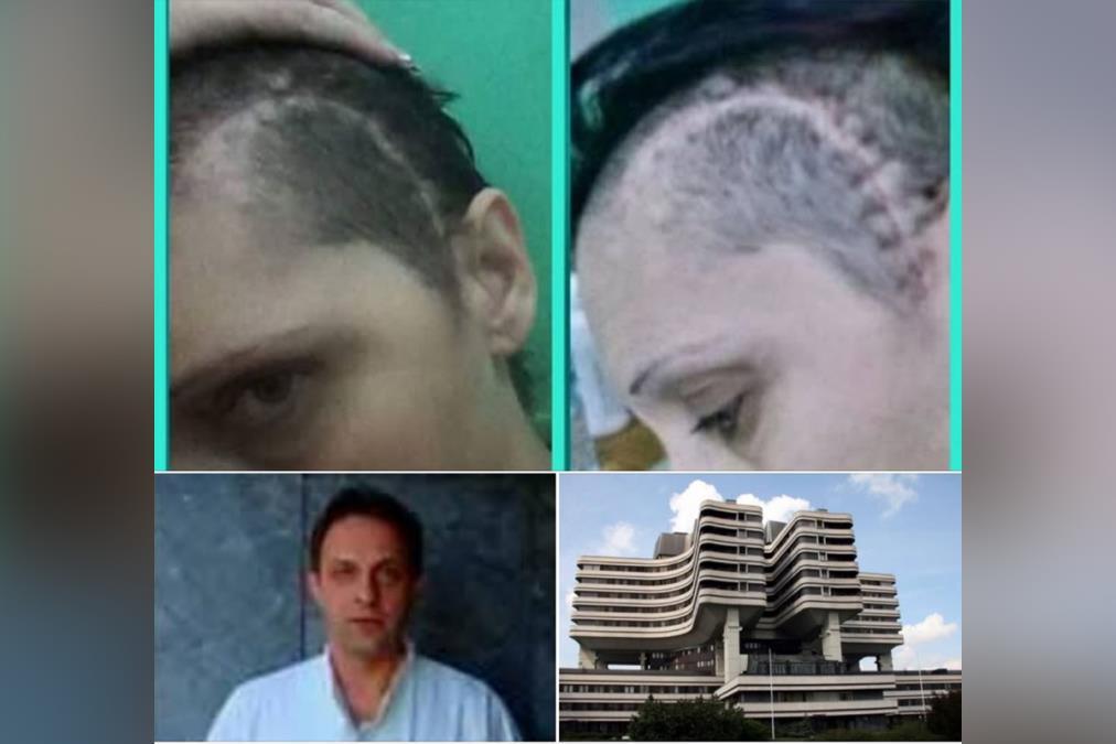 ruzicu-je-zabolela-glava,-a-onda-totalni-mrak:-“nisam-znala-ko-sam,-ni-kako-se-zovem!-pitala-sam-ko-me-je-osisao?” ruzicu-je-zabolela-glava,-a-onda-totalni-mrak:-“nisam-znala-ko-sam,-ni-kako-se-zovem!-pitala-sam-ko-me-je-osisao?”