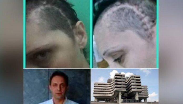 poruka-jedne-ruzice-nakon-prezivljenog-pakla:-dozivela-mozdani-udar,-nije-znala-ko-je,-a-sada-podelila-svoju-pricu