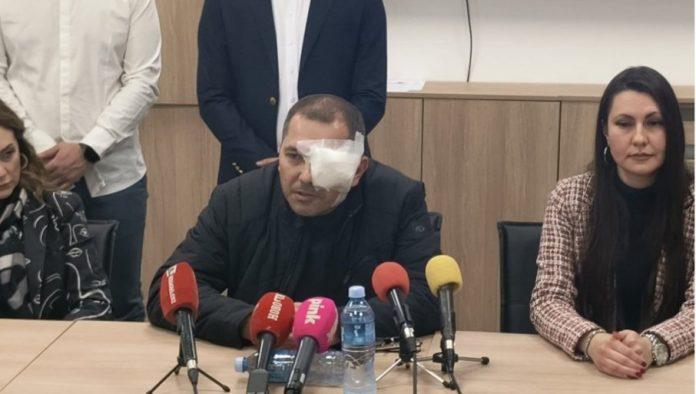 uzas-u-arandelovcu:-blokader-unakazio-coveka,-naneo-mu-tesku-povredu-oka-(foto/video)