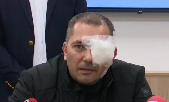 aktivista-sns-brutalno-napadnut-u-arandelovcu-zadobio-tesku-povredu-oka,-opisao-scene-uzasa:-“slomio-mi-je-naocare,-staklo-mi-je-uslo-u-oko!”-(foto/video)