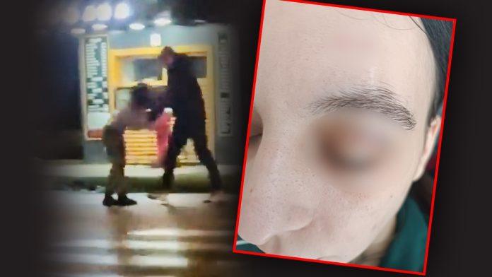 ovo-je-katarina-koju-je-pretukao-golman-davio-je-i-sutirao:-bacio-je-na-ulicu-i-nastavio-maltretiranje-(foto,video)