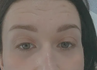 (FOTO) NAŠA PEVAČICA IZVADILA SILIKONE Završila na operaciji, hitno se oglasila: “Apelujem na sve mlade devojke da ne prave istu grešku” (foto)-nasa-pevacica-izvadila-silikone-zavrsila-na-operaciji,-hitno-se-oglasila:-“apelujem-na-sve-mlade-devojke-da-ne-prave-istu-gresku”