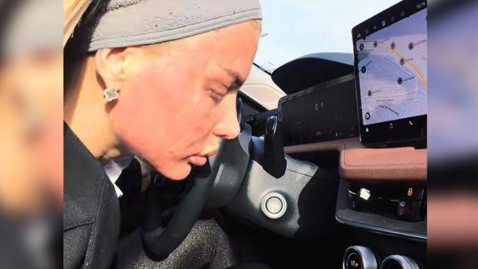 milici-kemez-celo-lice-crveno-i-u-oziljcima!-bivsa-zadrugarka-sokirala,-hladi-glavu-klimom-u-automobilu:-zabrinula-mnoge