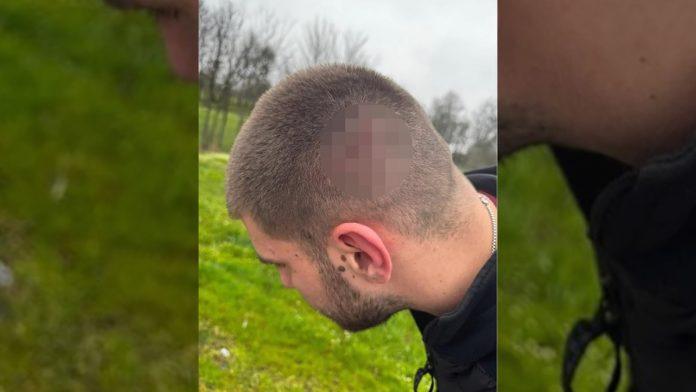 privedeno-5-osoba-sumnja-se-da-su-napali-aktivistu-sns-u-selu-ratari,-u-automobilu-pronadena-2-metka,-5-biber-sprejeva…-(foto)