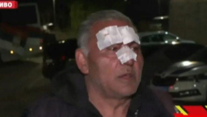 blokaderi-pretukli-neduznog-coveka-“oborili-su-me-na-zemlju,-sav-sam-u-krvi,-sve-me-boli”-(video)