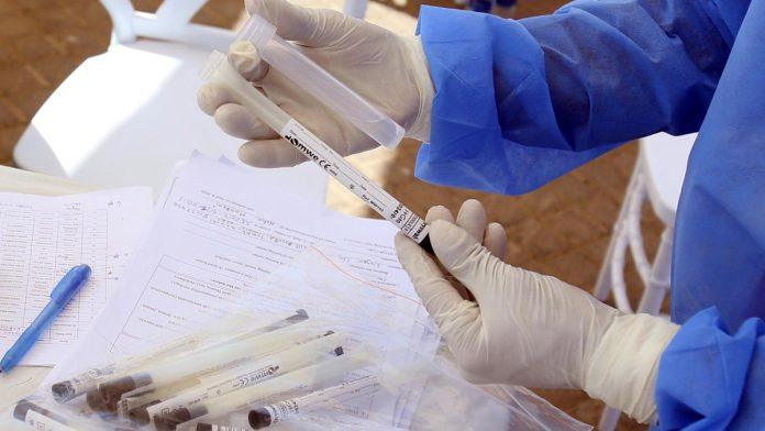 “lezao-je-i-patio-kao-da-je-bacen-u-vrelo-ulje”-vise-od-300-dece-u-jednom-gradu-zarazeno-opakim-virusom:-horor-u-pakistanu,-svi-pokupili-infekciju-u-istoj-bolnici?