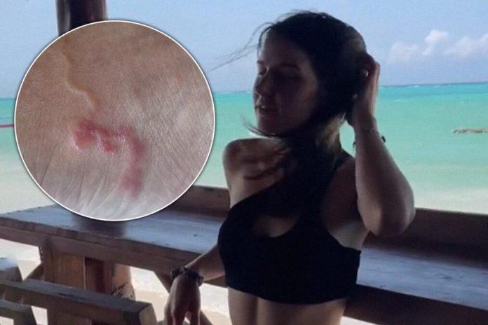 jovana-otisla-na-odmor-iz-snova,-a-vratila-se-sa-zivim-stanarom-u-kozi-koji-joj-pravi-pakao:-“gledala-sam-kako-putuje-kroz-mene”