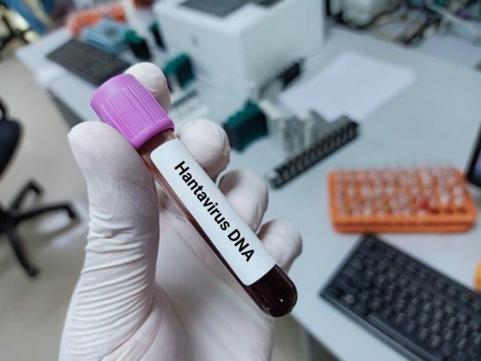 “hantavirus-je-prisutan-i-u-srbiji”:-batut-se-hitno-oglasio-o-smrtonosnoj-zarazi-–-ovo-su-prvi-simptomi