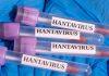 HANTAVIRUS NA KRUZERU: Da li je svet pred novom pandemijom ili je reč o nepotrebnoj panici? hantavirus-na-kruzeru:-da-li-je-svet-pred-novom-pandemijom-ili-je-rec-o-nepotrebnoj-panici?