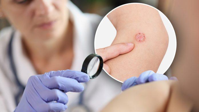 besplatan-pregled-mladeza-ispred-zgrade-opstine-novi-beograd