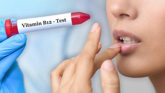 usta-su-cesto-prvo-mesto-na-telu-na-kojem-se-vidi-nedostatak-vitamina-b12