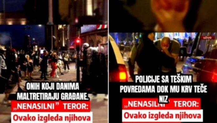 sav-krvav-nakon-napada-razularene-mase:-blokaderi-unakazali-policajca-jer-radi-svoj-posao