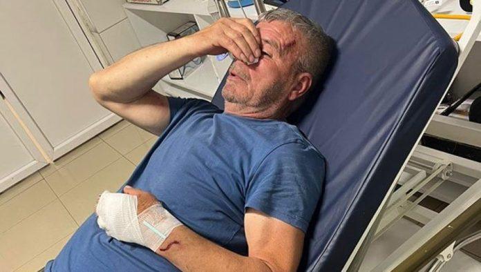 pretucen-srbin-iz-kosovskog-pomoravlja-dok-je-pokusao-da-zastiti-sina:-pretrpeo-brutalan-napad-od-strane-lokalnog-albanca