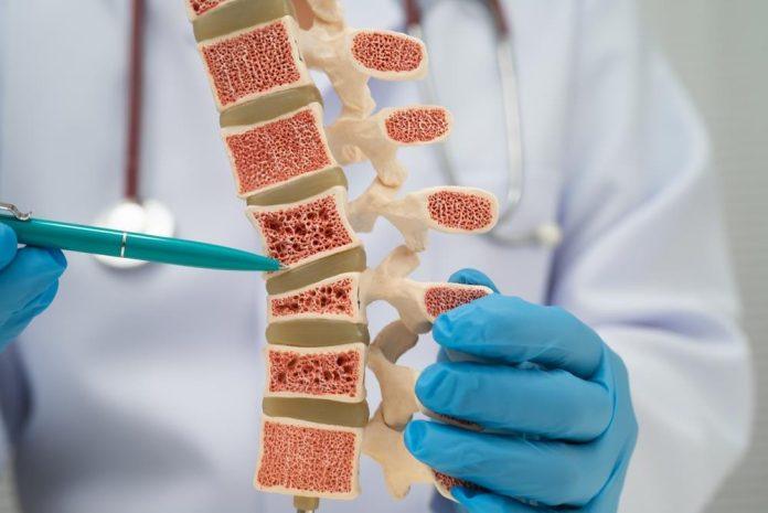 novo-otkrice-daje-nadu-obolelima-od-osteoporoze:-naucnici-uspeli-da-podstaknu-rast-novih-kostiju