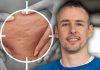 Problem koji muči čak 6 od 7 žena, a ne zaobilazi ni muškarce: Fitnes trener otkriva jedinu pravu formulu protiv celulita problem-koji-muci-cak-6-od-7-zena,-a-ne-zaobilazi-ni-muskarce:-fitnes-trener-otkriva-jedinu-pravu-formulu-protiv-celulita