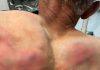 (UZNEMIRUJUĆE FOTOGRAFIJE) ODVELI GA U ŠUMU, VEZALI ZA DRVO I BRUTALNO TUKLI CREVOM ZA VODU! Jezivo nasilje tzv. kosovske policije nad Srbinom: Tražili da prizna da je počinio zločin (VIDEO) (uznemirujuce-fotografije)-odveli-ga-u-sumu,-vezali-za-drvo-i-brutalno-tukli-crevom-za-vodu!-jezivo-nasilje-tzv.-kosovske-policije-nad-srbinom:-trazili-da-prizna-da-je-pocinio-zlocin-(video)