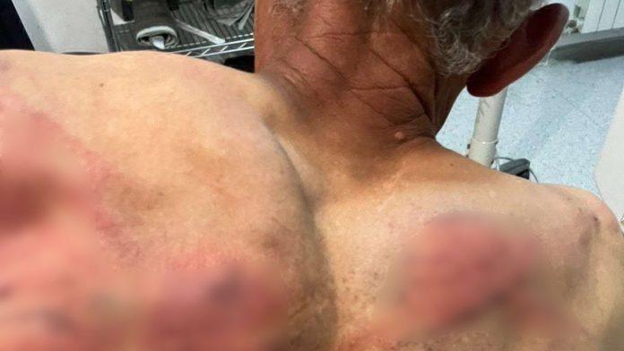 (uznemirujuce-fotografije)-odveli-ga-u-sumu,-vezali-za-drvo-i-brutalno-tukli-crevom-za-vodu!-jezivo-nasilje-tzv.-kosovske-policije-nad-srbinom:-trazili-da-prizna-da-je-pocinio-zlocin-(video)