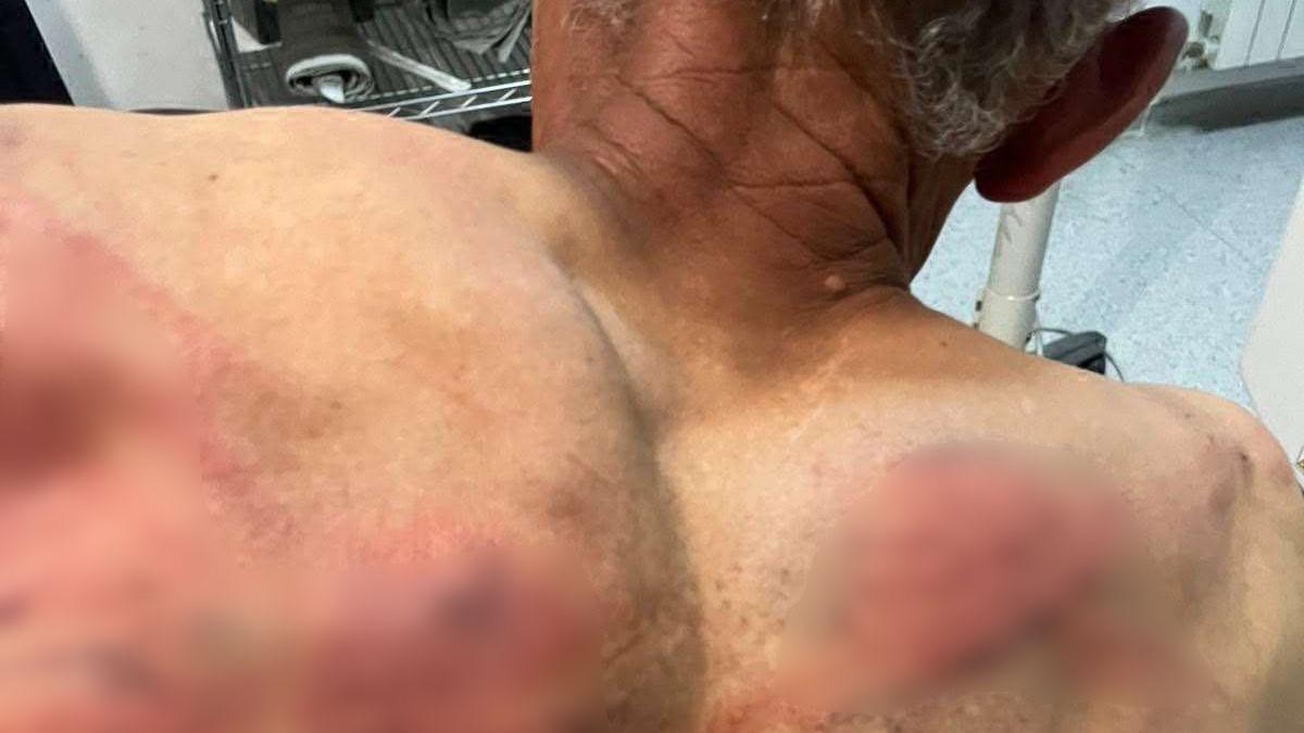(uznemirujuce-fotografije)-odveli-ga-u-sumu,-vezali-za-drvo-i-brutalno-tukli-crevom-za-vodu!-jezivo-nasilje-tzv.-kosovske-policije-nad-srbinom:-trazili-da-prizna-da-je-pocinio-zlocin-(video) (uznemirujuce-fotografije)-odveli-ga-u-sumu,-vezali-za-drvo-i-brutalno-tukli-crevom-za-vodu!-jezivo-nasilje-tzv.-kosovske-policije-nad-srbinom:-trazili-da-prizna-da-je-pocinio-zlocin-(video)