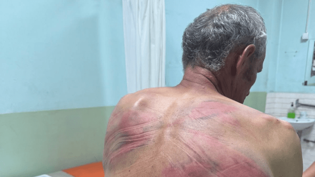 Припадници-косовске-полиције-претукли-Ненада-Рашковића-код-Зубиног-Потока:-Упали-у-кућу,-малтретирали-ми-жену-и-сина Припадници-косовске-полиције-претукли-Ненада-Рашковића-код-Зубиног-Потока:-Упали-у-кућу,-малтретирали-ми-жену-и-сина