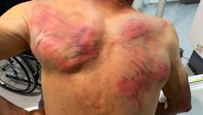jezivo!-kurtijevi-policajci-tukli-srbina:-vezali-ga-za-drvo-pa-se-izivljavali-(foto)