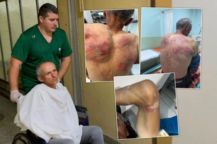 “trojica-mi-dosla-u-kucu…-vezali-me-za-bukvu-i-tukli-crevom”-iz-bolnice-se-oglasio-nenad-kog-je-kurtijeva-policija-brutalno-pretukla:-otkrio-sta-su-mu-trazili