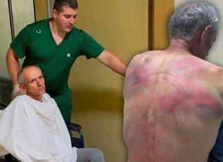 (FOTO, VIDEO) “STAVILI SU MI LISICE, KRPU NA USTA, VEZALI ME ZA BUKVU I TUKLI” Oglasio se Nenad kog je tzv. kosovska policija brutalno pretukla: “Upala su trojica u moju kuću…” (foto,-video)-“stavili-su-mi-lisice,-krpu-na-usta,-vezali-me-za-bukvu-i-tukli”-oglasio-se-nenad-kog-je-tzv.-kosovska-policija-brutalno-pretukla:-“upala-su-trojica-u-moju-kucu…”