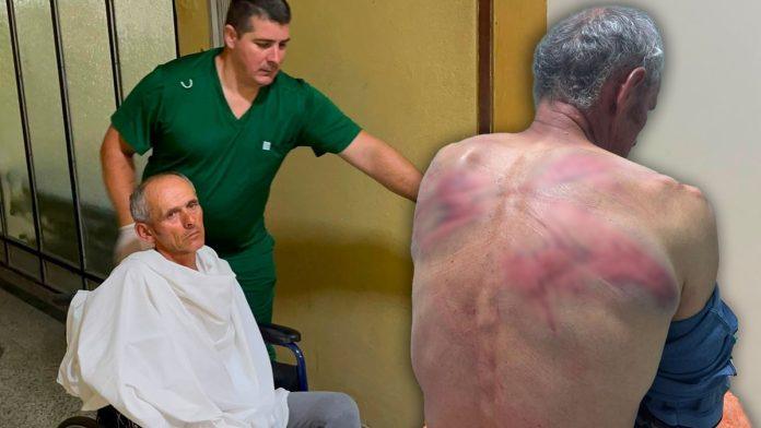 (foto,-video)-“stavili-su-mi-lisice,-krpu-na-usta,-vezali-me-za-bukvu-i-tukli”-oglasio-se-nenad-kog-je-tzv.-kosovska-policija-brutalno-pretukla:-“upala-su-trojica-u-moju-kucu…”