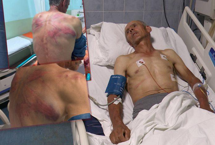 “trazili-mi-pusku,-a-ja-pusku-nemam”-pretuceni-srbin-nenad-iz-drena-na-kosmetu-o-detaljima-krvnickog-prebijanja?!-pretili-i-zeni:-hoces-da-te-teramo-u-albaniju