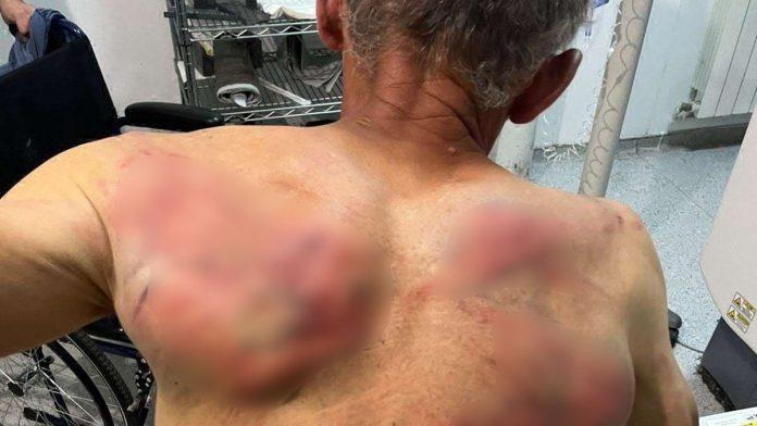 “ovo-su-bezbednosne-pretnje”-vujinovic-o-brutalnom-napadu-na-raskovica-na-kosovu:-nije-izolovani-incident,-srbi-su-ozbiljno-ugrozeni!