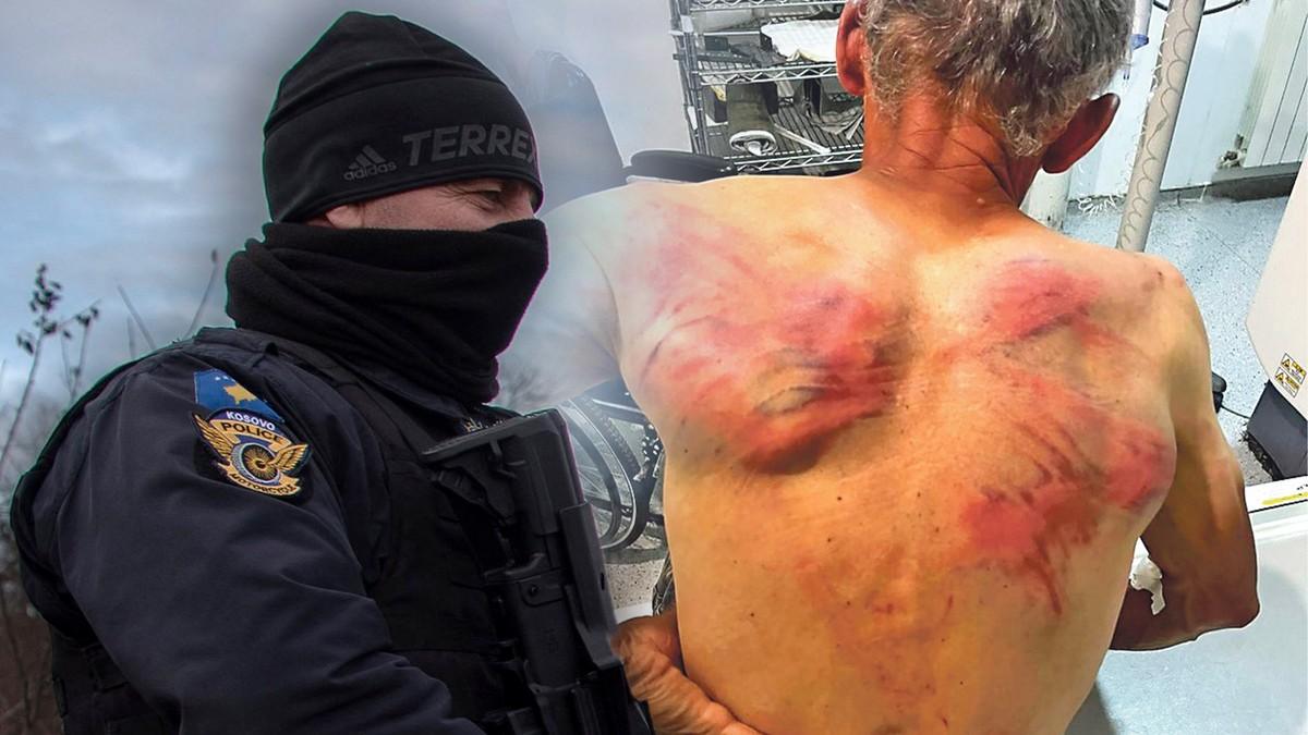 pucnjave,-prebijanja,-napadi-na-decu!-geneza-nasilja-nad-srbima-na-kosovu-i-metohiji:-ovo-je-teror-koji-kurtijev-rezim-sprovodi-dok-zapad-cuti-(foto) pucnjave,-prebijanja,-napadi-na-decu!-geneza-nasilja-nad-srbima-na-kosovu-i-metohiji:-ovo-je-teror-koji-kurtijev-rezim-sprovodi-dok-zapad-cuti-(foto)