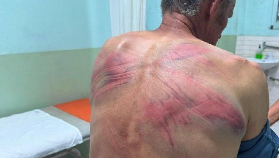 suspenzija-policajaca-nije-dovoljna-za-takav-zlocin-simic:-potrebna-odgovornost-pred-sudom suspenzija-policajaca-nije-dovoljna-za-takav-zlocin-simic:-potrebna-odgovornost-pred-sudom