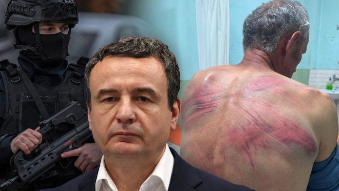 eksplozija-kurtijevog-pritiska-na-srbe-na-kosovu-mucenje-i-vezivanje-za-drvo,-bageri-na-gazivodama-i-rampa-za-srpske-tuzioce,-a-cilj-moze-biti-samo-jedan