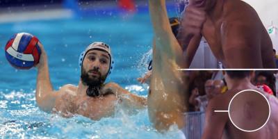 ozbiljan-skandal-u-finalu-vaterpola!-ujeo-igraca-u-sred-igre-za-ruku-i-leda ozbiljan-skandal-u-finalu-vaterpola!-ujeo-igraca-u-sred-igre-za-ruku-i-leda