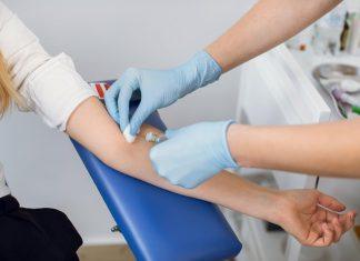 Veliki preokret u medicini! Analiza 9,7 miliona rezultata srušila staro pravilo: Gladovanje pre vađenja krvi više nije neophodno za većinu analiza! veliki-preokret-u-medicini!-analiza-9,7-miliona-rezultata-srusila-staro-pravilo:-gladovanje-pre-vadenja-krvi-vise-nije-neophodno-za-vecinu-analiza!