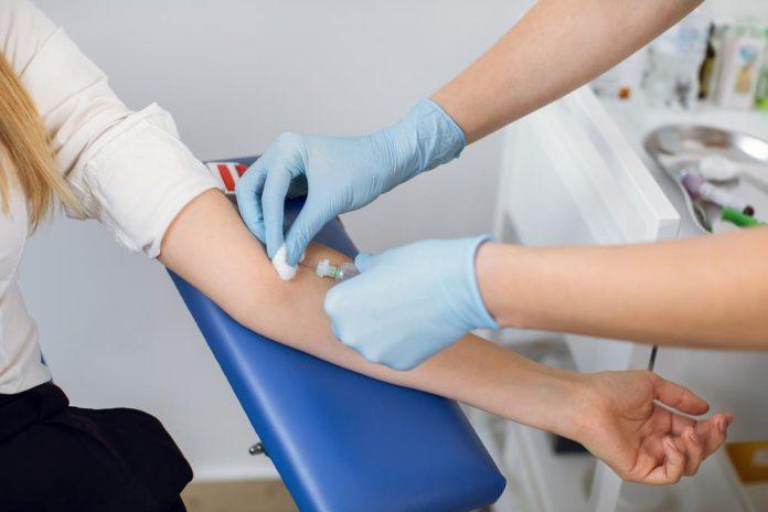 veliki-preokret-u-medicini!-analiza-9,7-miliona-rezultata-srusila-staro-pravilo:-gladovanje-pre-vadenja-krvi-vise-nije-neophodno-za-vecinu-analiza!